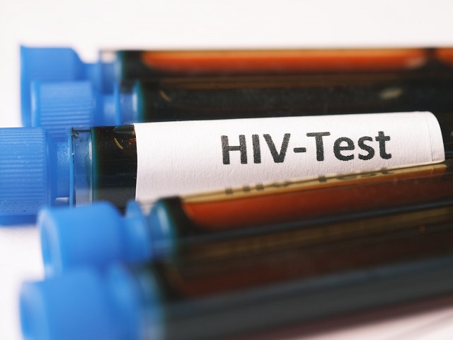 7 Seven Signs You May Have HIV/AIDS -- Symptoms, Causes, Effects, Treatment and Prevention