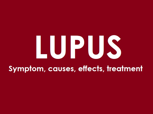 10 Signs You May Have Lupus -- Symptoms, Causes, Effects, Treatment and Prevention