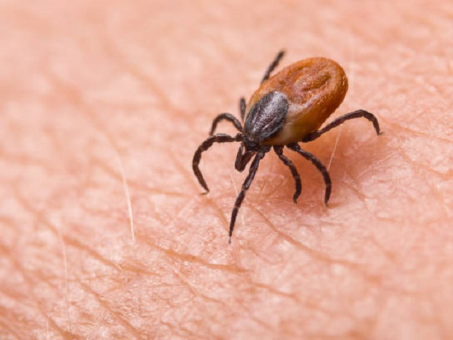 5 Signs You Have Lyme Disease -- Symptoms, Causes, Effects, Treatment and Prevention
