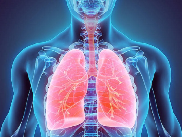 8 Signs You May Have Pneumonia -- Symptoms, Causes, Effects, Treatment and Prevention