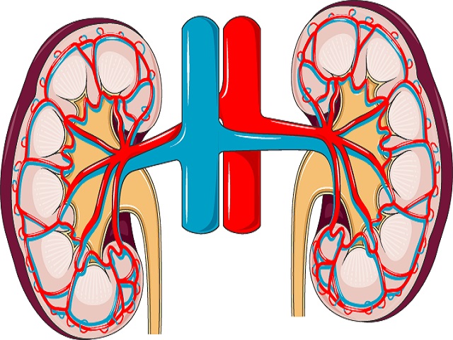 6 Signs You May Have Nephrotic Syndrome -- Symptoms, Causes, Effects, Treatment and Prevention