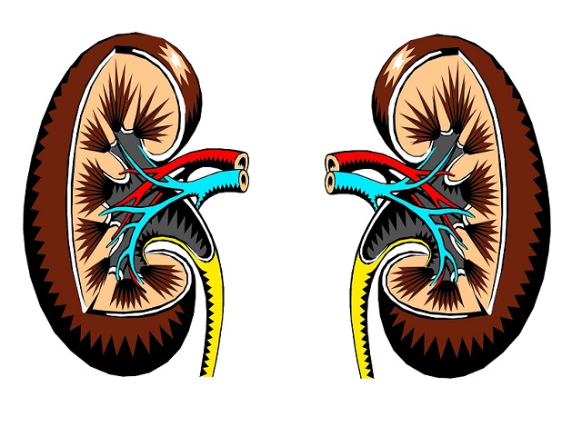 6 Signs You May Have Renal Cell Carcinoma -- Symptoms, Causes, Effects, Treatment and Prevention