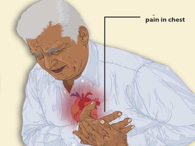 7 Signs You May Have Pulmonary Hypertension -- Symptoms, Causes, Effects, Treatment and Prevention