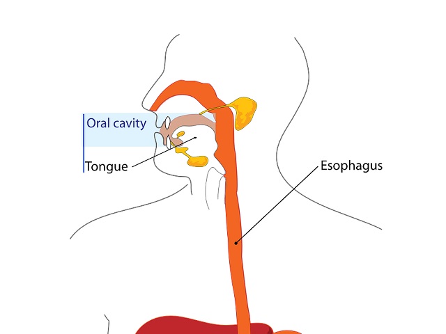 6 Signs You May Have Esophageal Cancer -- Symptoms, Causes, Effects ...